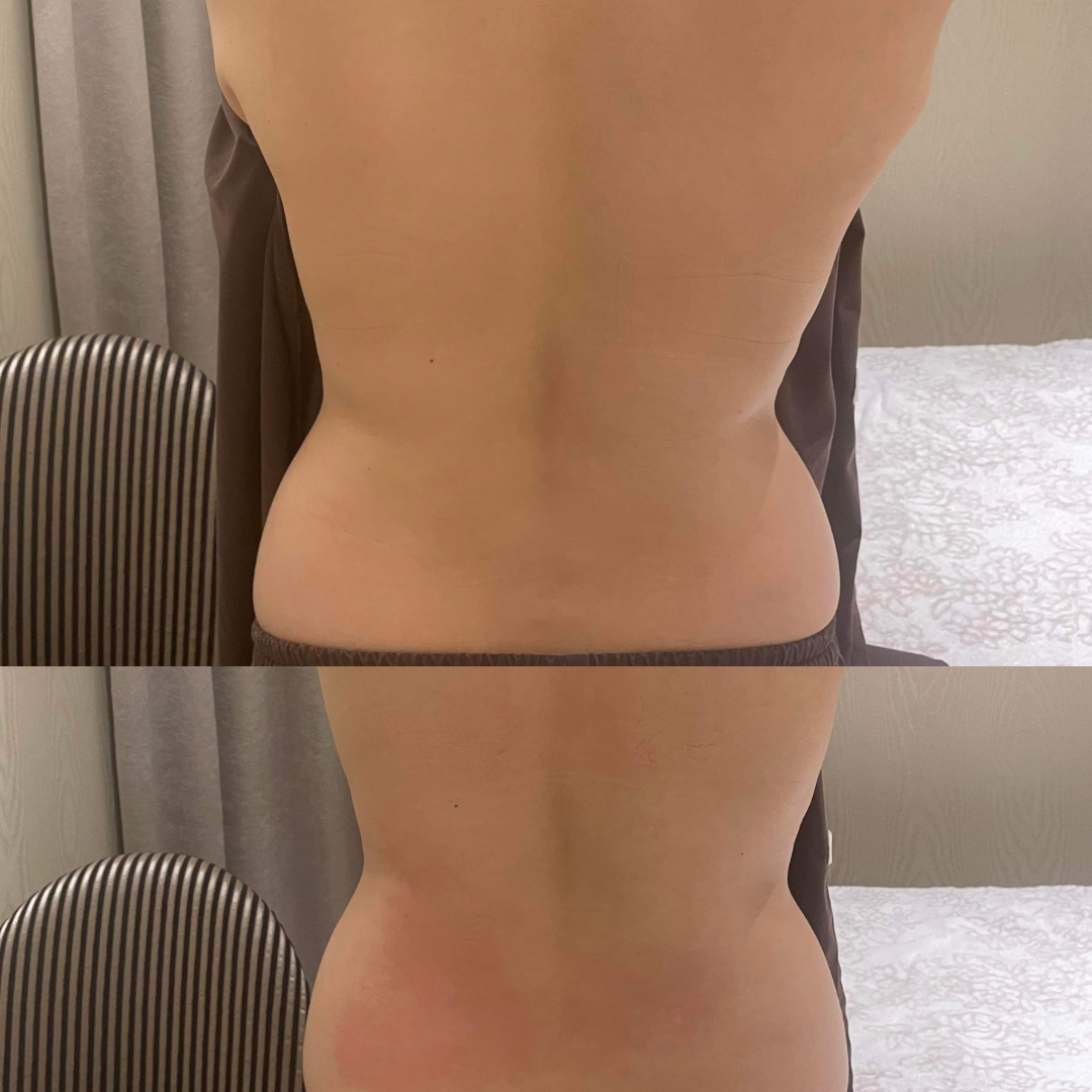 トーンヌールダイエット鍼灸 – kokyuminamiaoyama